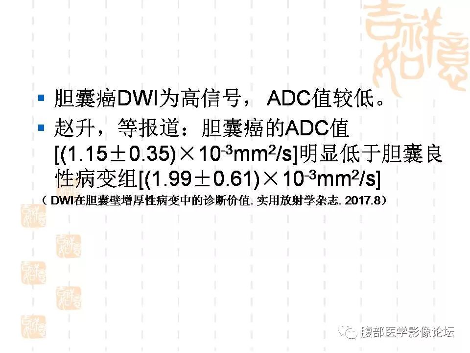 【病例】胆囊癌1例CT及MR影像表现