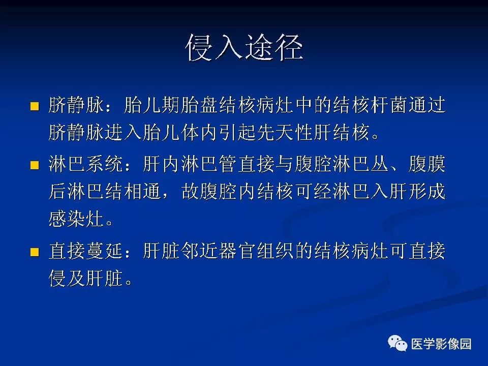 【PPT】肝脏结核CT表现