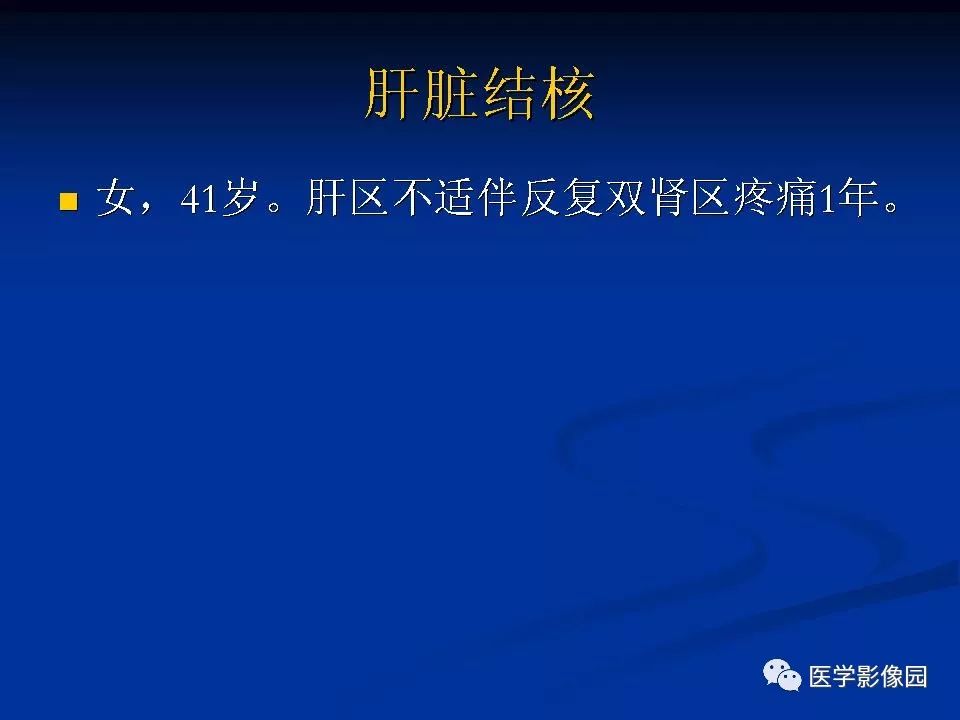 【PPT】肝脏结核CT表现
