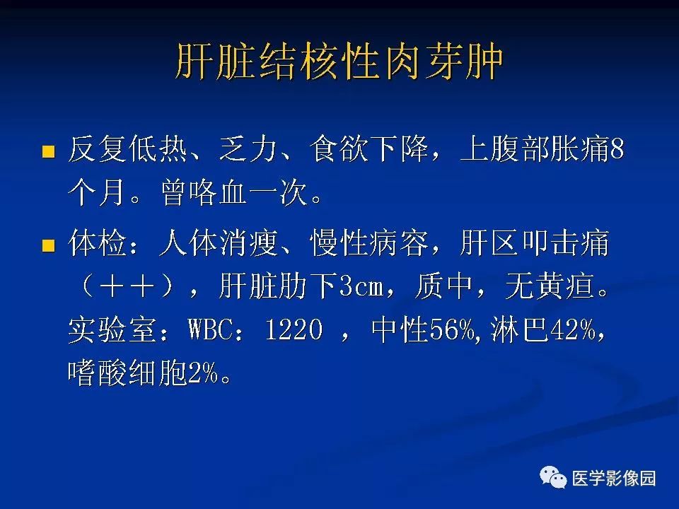 【PPT】肝脏结核CT表现