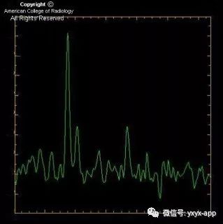 【病例】肾上腺脑白质营养不良1例影像诊断分析