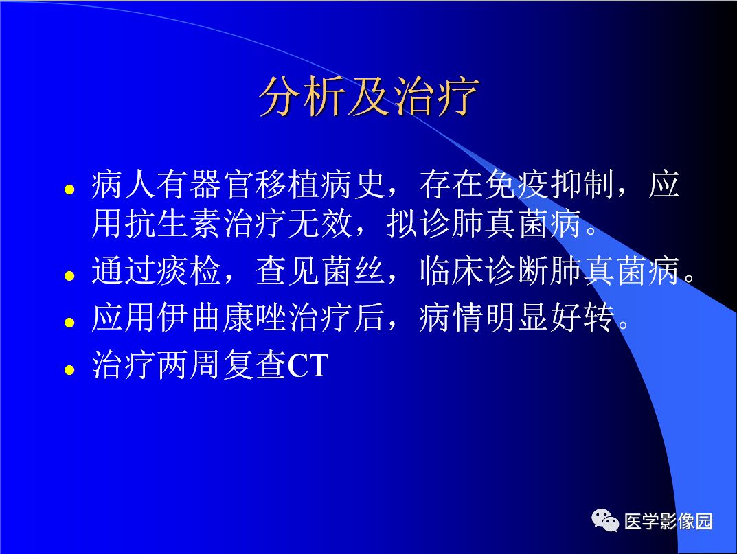 【病例】肺真菌病1例CT影像表现