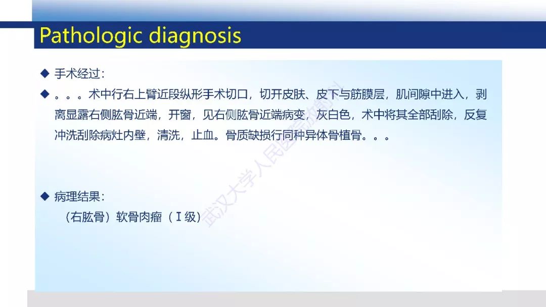 【PPT】软骨肉瘤影像诊断