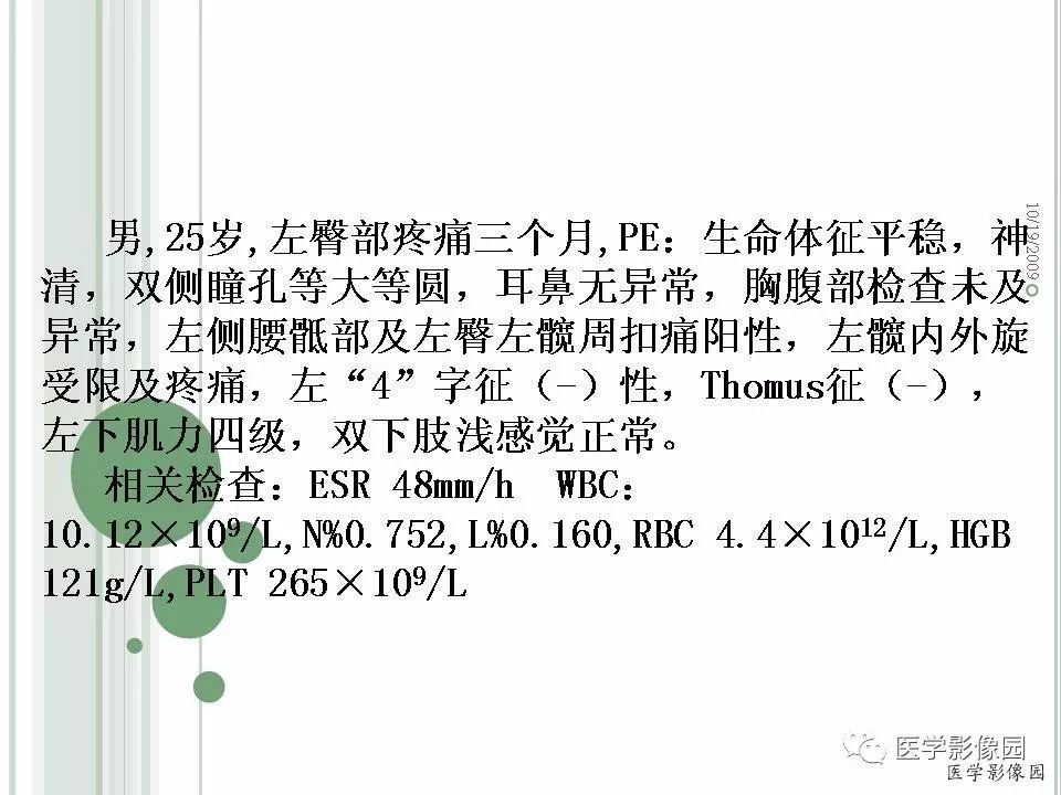 【病例】髂骨恶性淋巴瘤1例CT及MR
