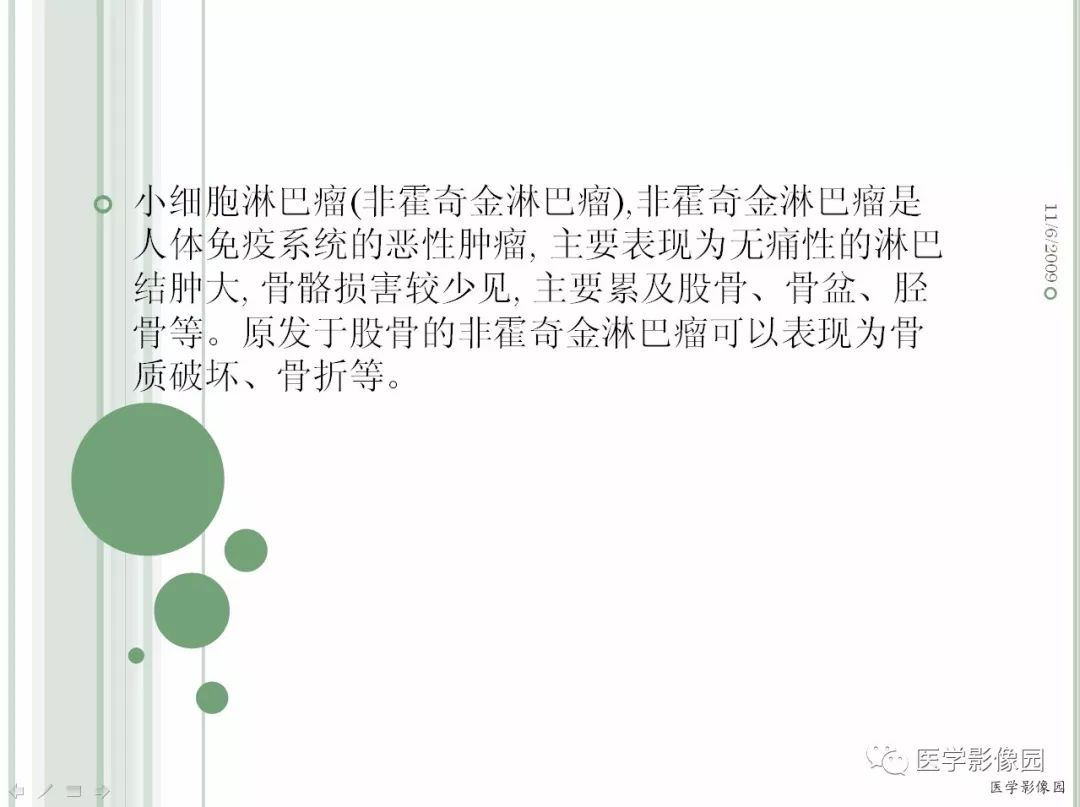 【病例】髂骨恶性淋巴瘤1例CT及MR