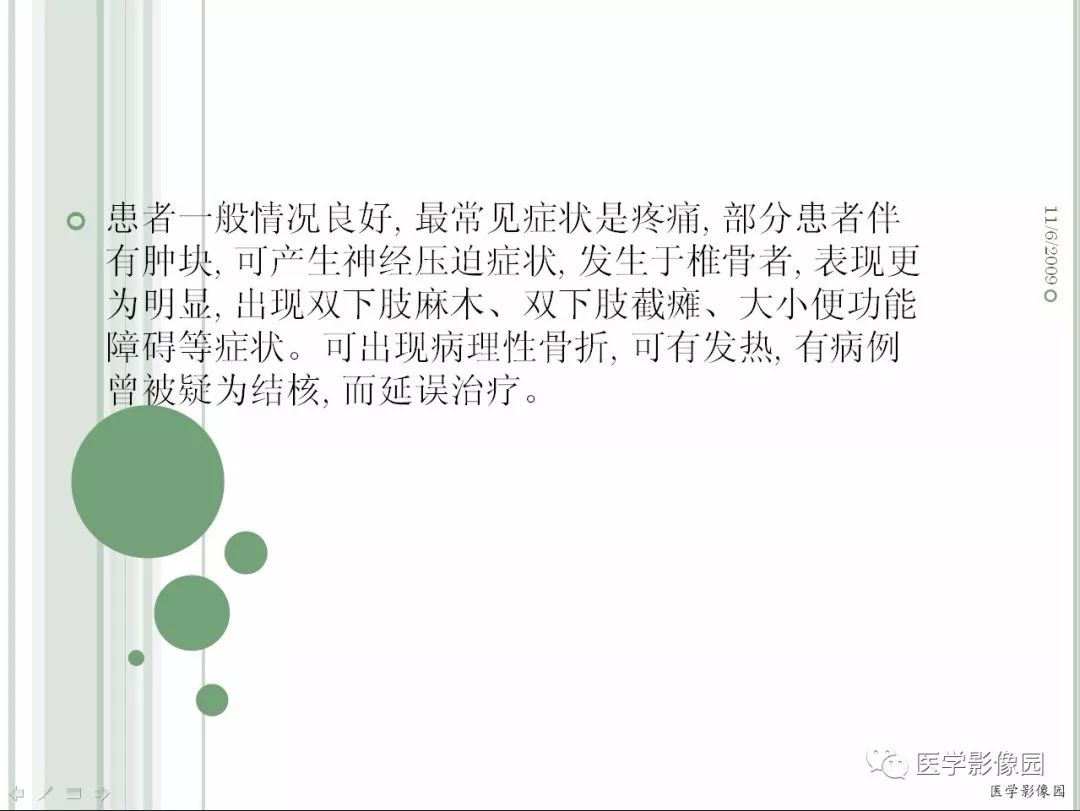 【病例】髂骨恶性淋巴瘤1例CT及MR