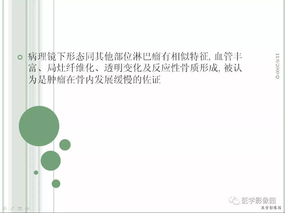 【病例】髂骨恶性淋巴瘤1例CT及MR