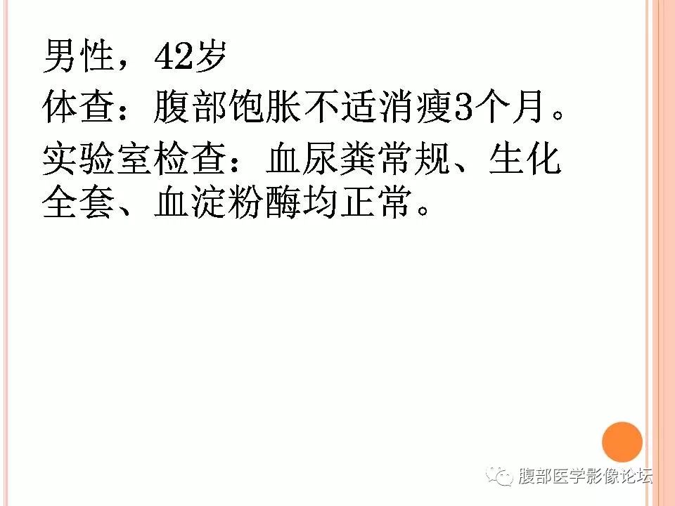 【病例】卵巢甲状腺肿1例CT