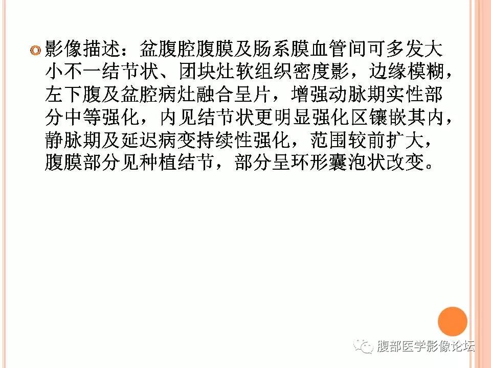 【病例】卵巢甲状腺肿1例CT