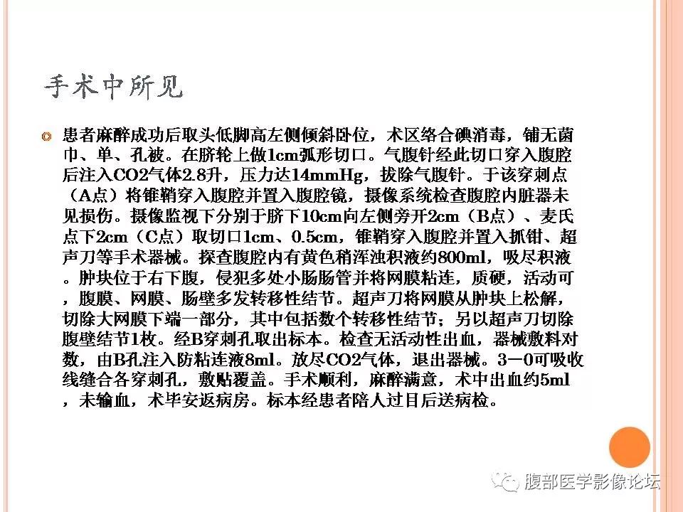 【病例】卵巢甲状腺肿1例CT