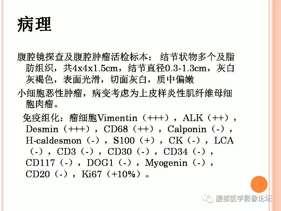 【病例】卵巢甲状腺肿1例CT