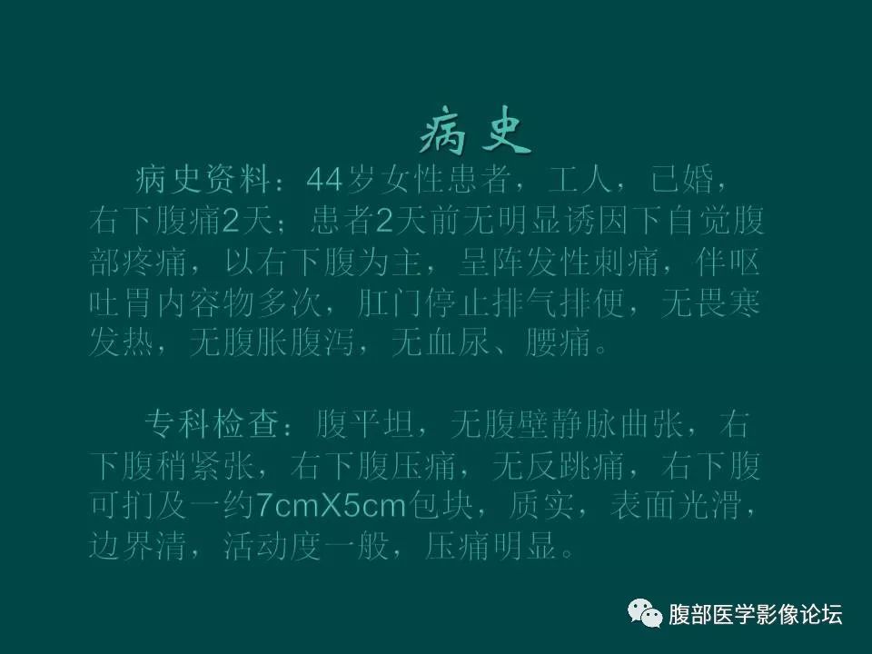 【病例】卵巢甲状腺肿1例CT