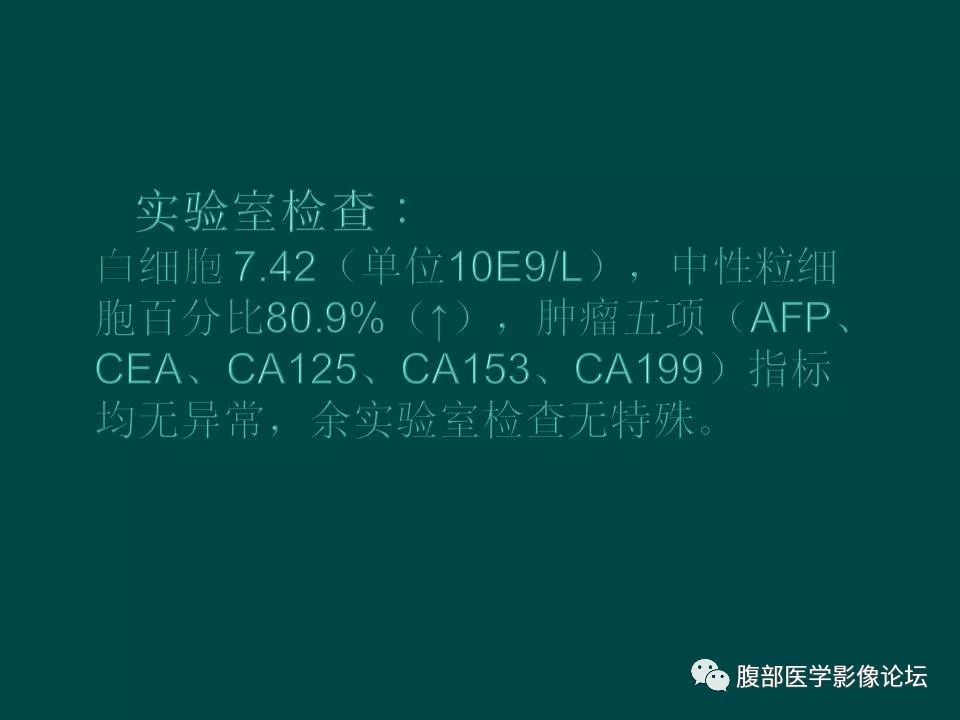 【病例】卵巢甲状腺肿1例CT