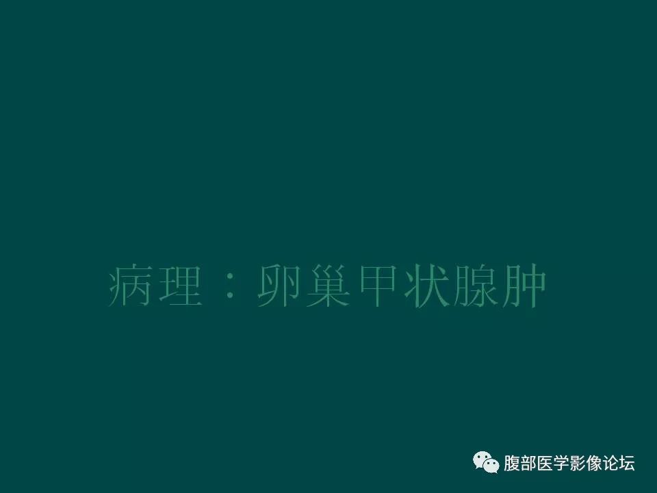 【病例】卵巢甲状腺肿1例CT