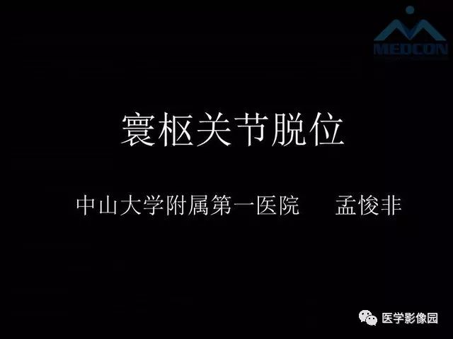 【PPT】寰枢关节脱位的影像诊断