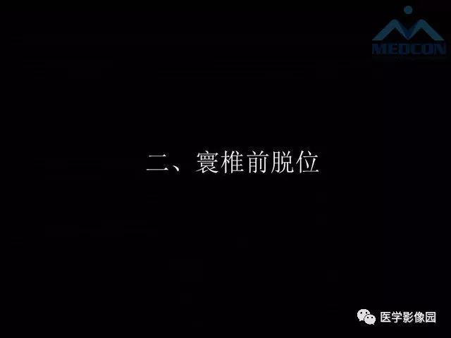 【PPT】寰枢关节脱位的影像诊断
