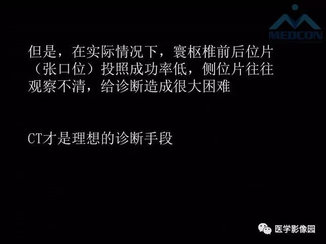 【PPT】寰枢关节脱位的影像诊断