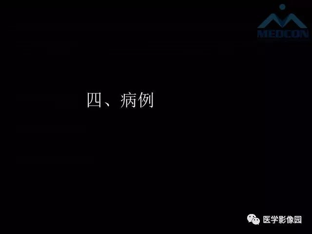 【PPT】寰枢关节脱位的影像诊断
