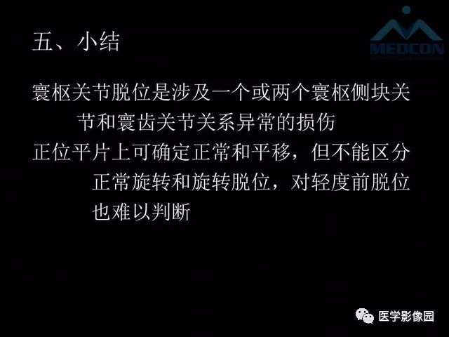 【PPT】寰枢关节脱位的影像诊断