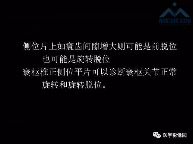 【PPT】寰枢关节脱位的影像诊断