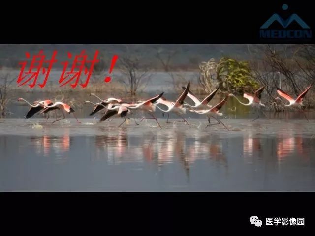 【PPT】寰枢关节脱位的影像诊断