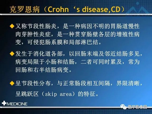 【PPT】克罗恩病的MSCT诊断