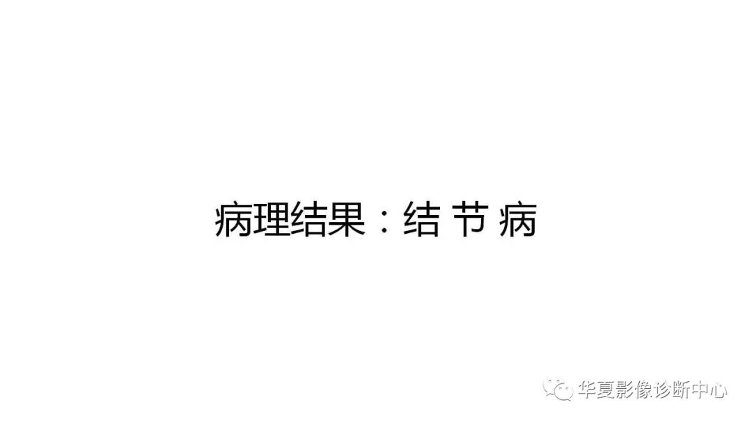 【病例】肺结节病1例CT影像表现