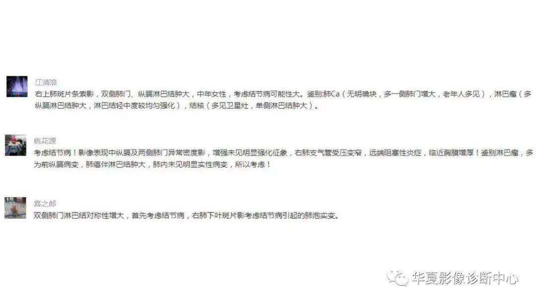 【病例】肺结节病1例CT影像表现