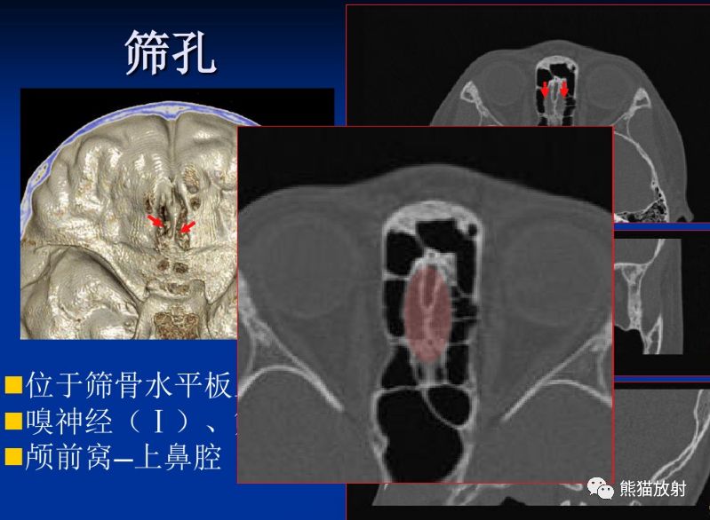 颅底孔道及内容物