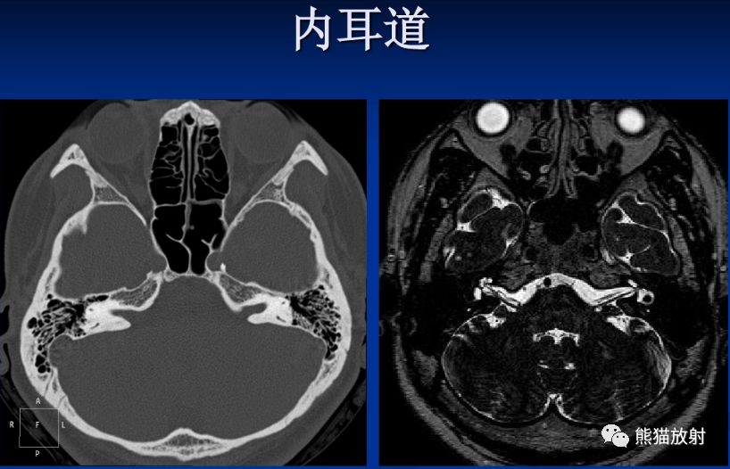 颅底孔道及内容物