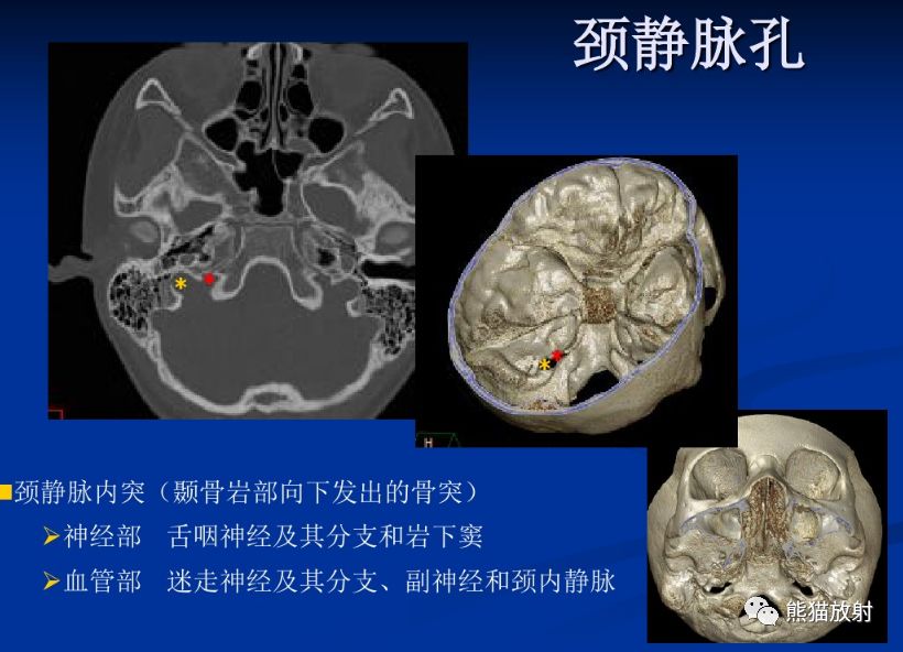 颅底孔道及内容物