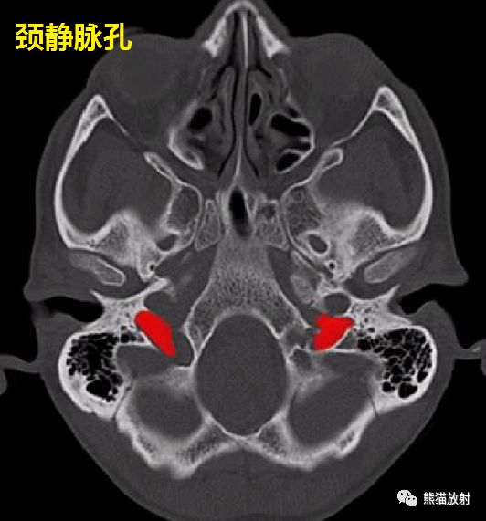 颅底孔道及内容物