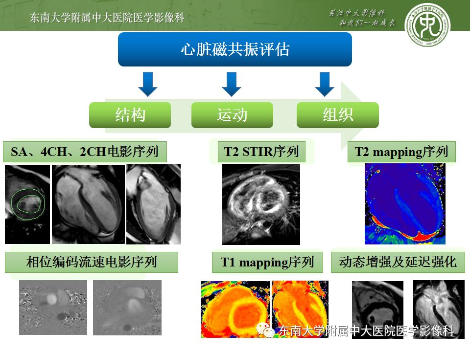 【病例】肥厚性心肌病1例MR 【病例】肥厚性心肌病1例MR