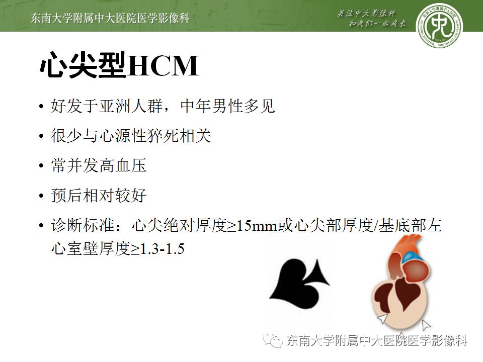【病例】肥厚性心肌病1例MR 【病例】肥厚性心肌病1例MR