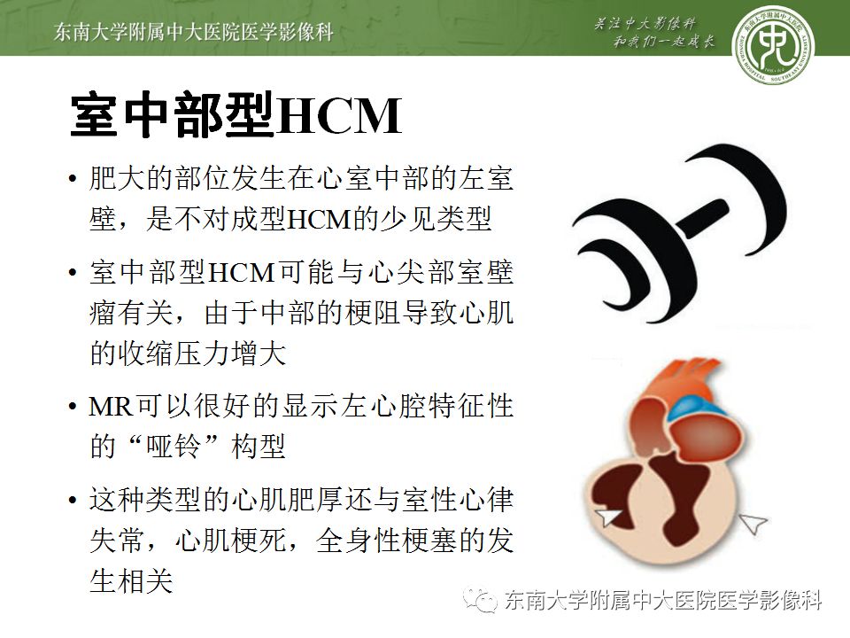 【病例】肥厚性心肌病1例MR 【病例】肥厚性心肌病1例MR