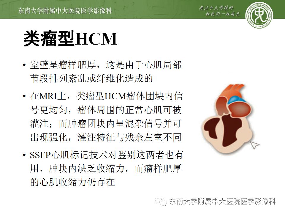 【病例】肥厚性心肌病1例MR 【病例】肥厚性心肌病1例MR