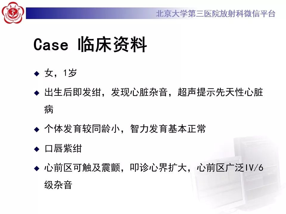 【病例】先天性心脏病——房室间隔缺损