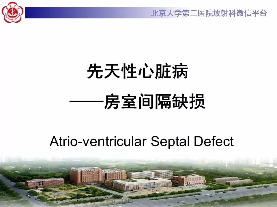 【病例】先天性心脏病——房室间隔缺损