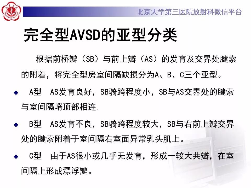 【病例】先天性心脏病——房室间隔缺损