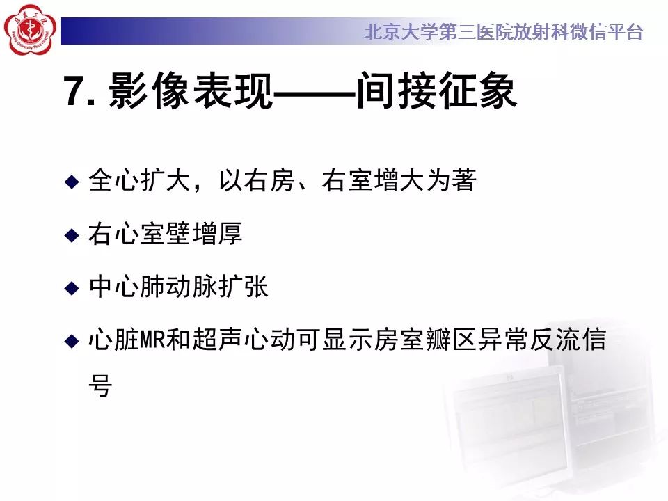 【病例】先天性心脏病——房室间隔缺损