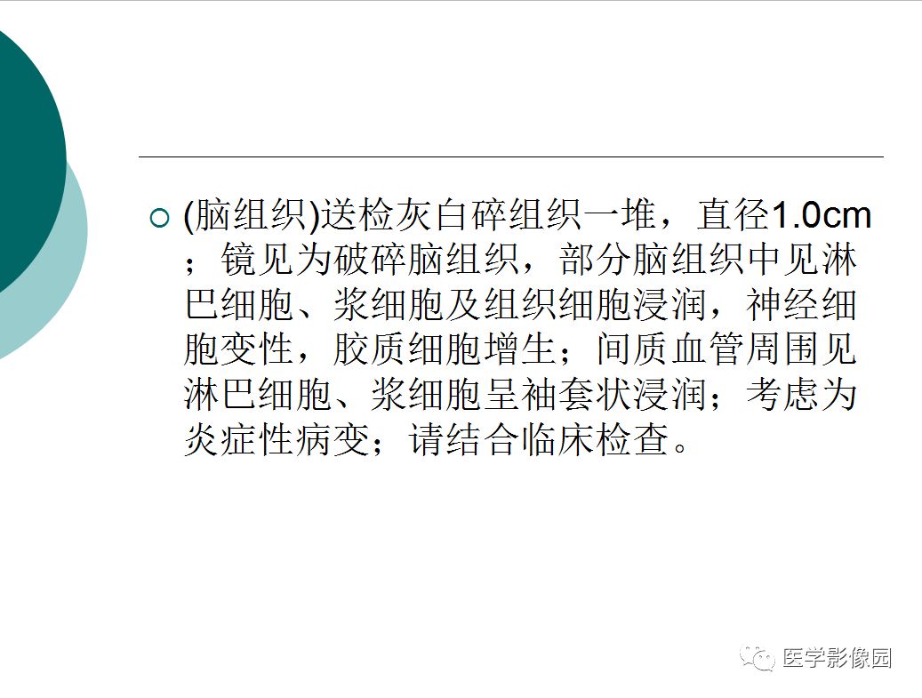 【病例】梅毒性脑炎1例MR