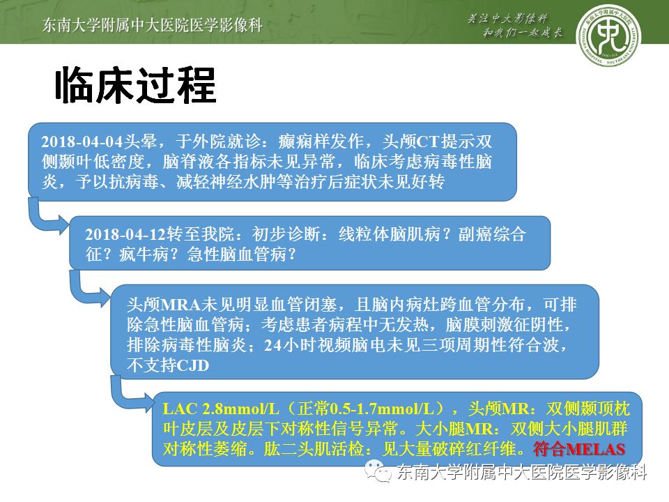 【病例】线粒体脑肌病1例MR影像表现
