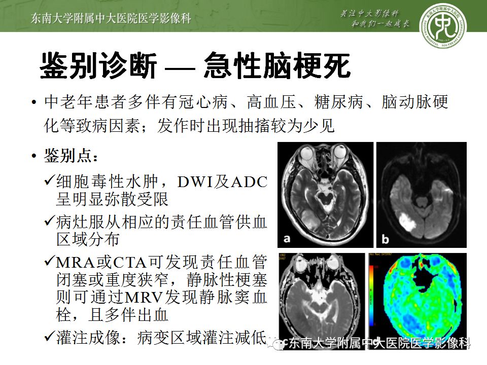 【病例】线粒体脑肌病1例MR影像表现