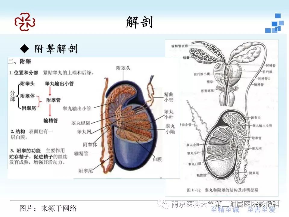 【病例】附睾恶性间皮瘤1例MR
