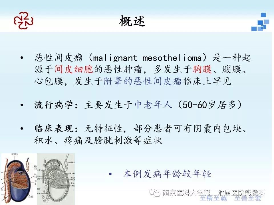 【病例】附睾恶性间皮瘤1例MR