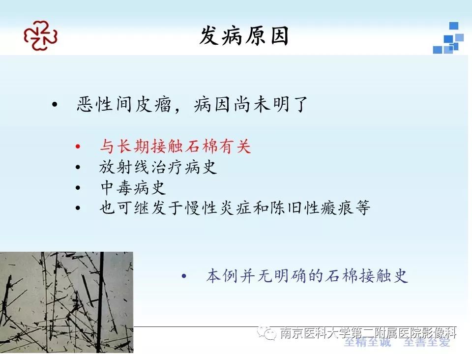 【病例】附睾恶性间皮瘤1例MR