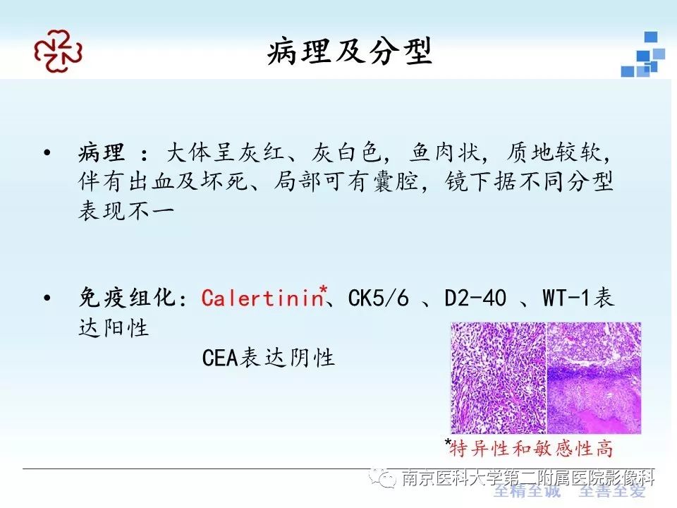 【病例】附睾恶性间皮瘤1例MR