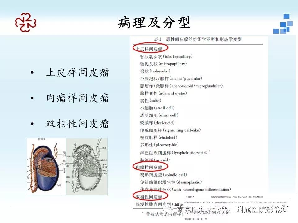 【病例】附睾恶性间皮瘤1例MR