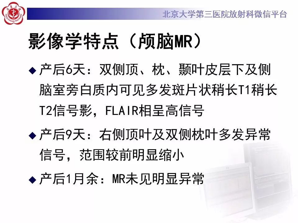 【病例】可逆性后部脑病综合征1例MR