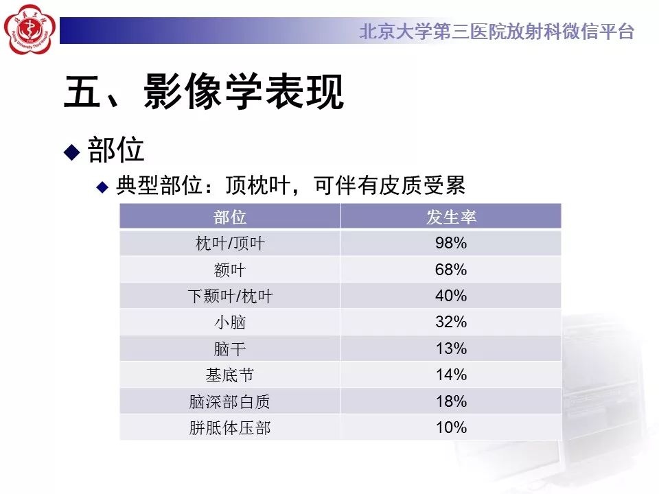 【病例】可逆性后部脑病综合征1例MR